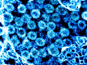 NIH image of coronavirus COVID-19
